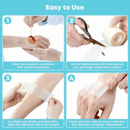 Hydrocolloid Patch Roll (Cut-to-Size Wound Care)